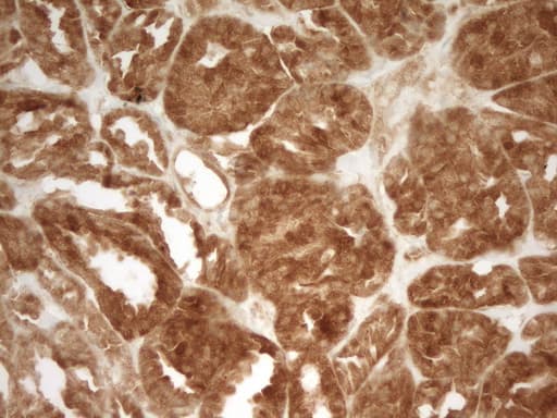 Monoclonal Mouse anti-Human PRMT5 Antibody (clone OTI4G7, aa238-499, IHC)