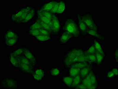 Polyclonal Rabbit anti-Human NUDT5 Antibody (IHC, IF)