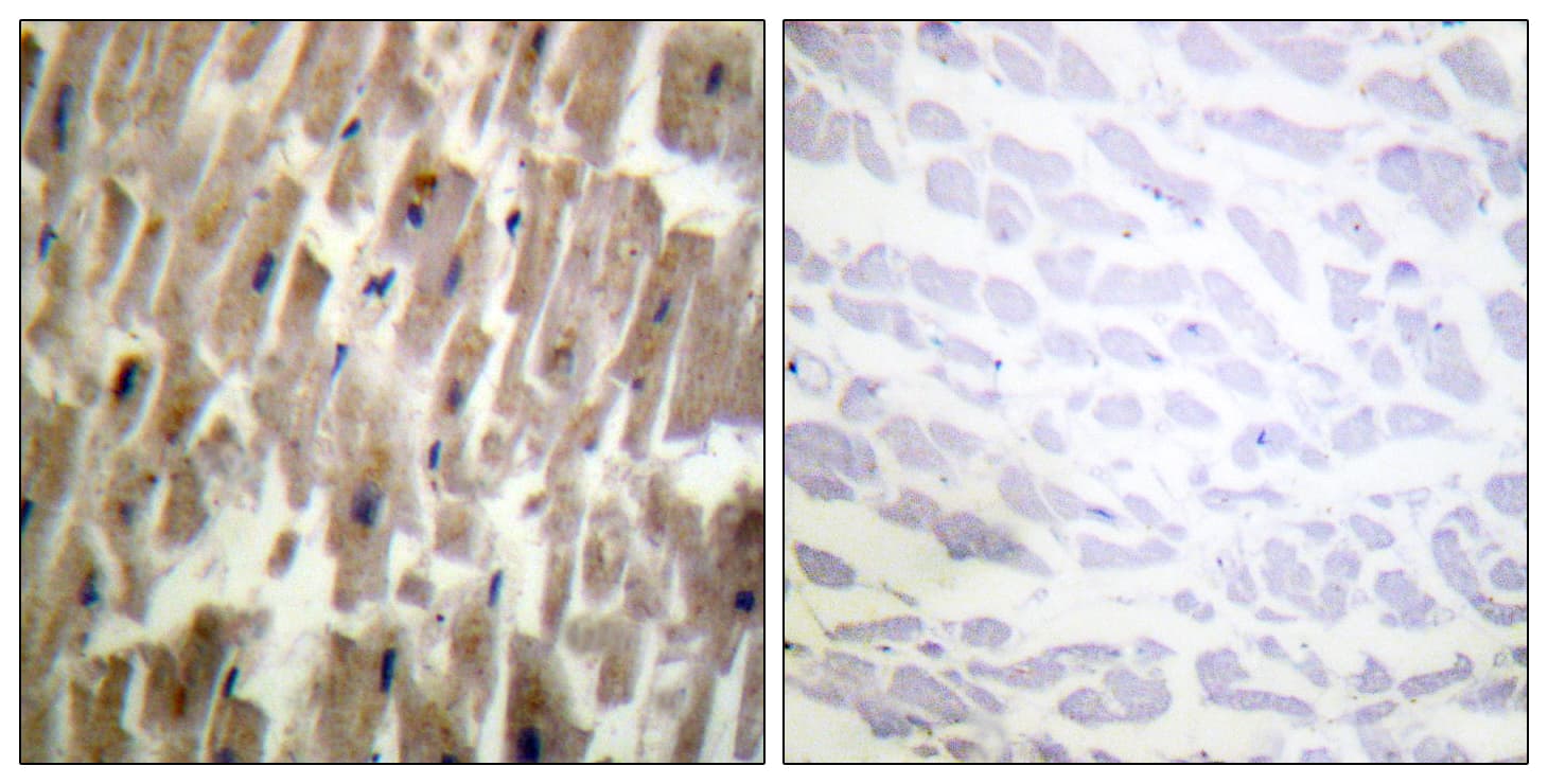 CRYAB / Alpha B Crystallin Antibody (phospho-Ser45)
