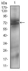 IHC-plus™ Monoclonal Mouse anti-Human NT5E / eNT / CD73 Antibody (clone 4G6B10, aa30-250, IHC, WB)