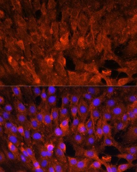 CISH / SOCS Antibody