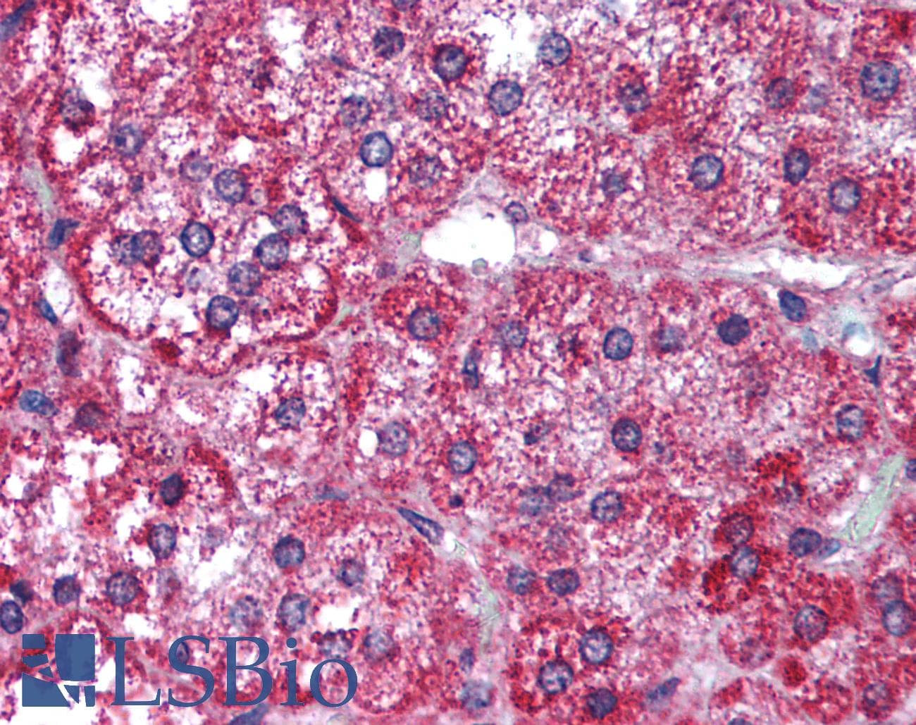 IHC-plus™ OPTN / Optineurin Antibody (aa115-130)