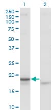 Monoclonal Mouse anti-Human CRH / CRF Antibody (clone 2B11, WB)