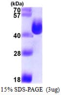 E. coli L-asparaginase I / ansA Protein (Recombinant His)