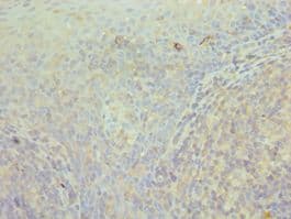 Polyclonal Rabbit anti-Human CCT3 Antibody (aa1-300, IHC, WB)