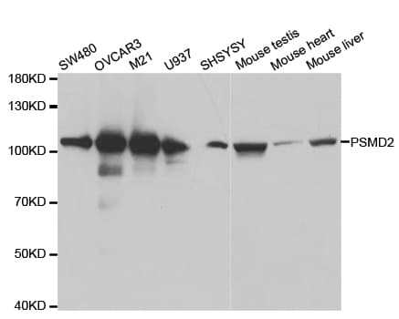 Polyclonal Rabbit anti-Human PSMD2 Antibody (IHC, IF, WB)