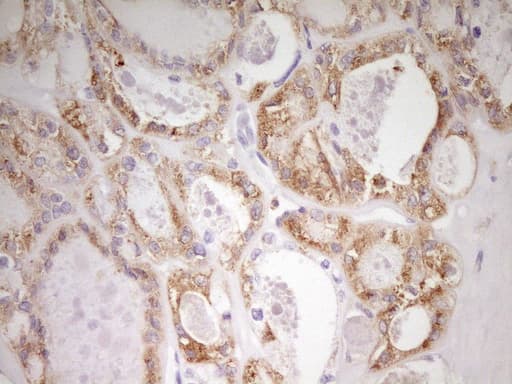 Monoclonal Mouse anti-Human MED15 / ARC105 Antibody (clone OTI1H5, Carrier-free, aa393-679, IHC, WB)