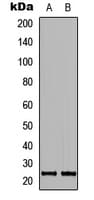 Polyclonal Rabbit anti-Human MRPL40 Antibody (Internal, IHC, WB)