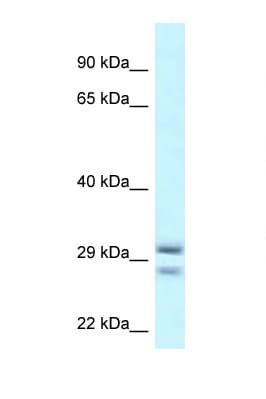 RIT1 Antibody (aa108-157)