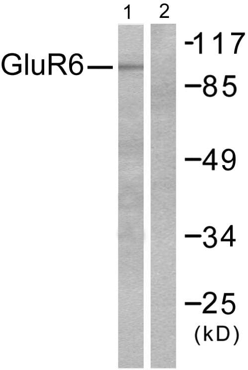 Polyclonal Rabbit anti-Human GRIK2 / GLUR6 Antibody (IHC, WB)