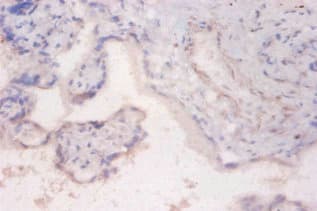 RPS6KB2 / S6K2 Antibody