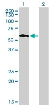 PIKFYVE / PIP5K Antibody (clone 6C7)