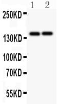 COL3A1 / Collagen III Antibody (aa1200-1221)