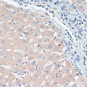 DBH/Dopamine Beta Hydroxylase Antibody