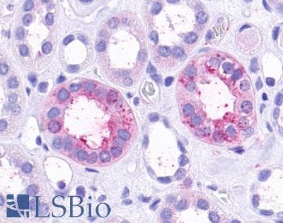 PathPlus™ TAAR9 Antibody (Extracellular Domain)
