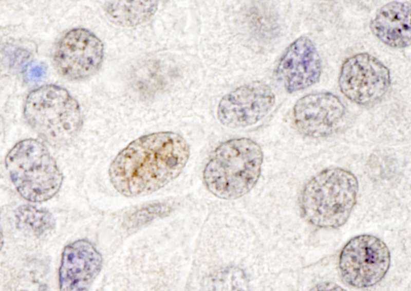GATAD2B Antibody (aa50-100)
