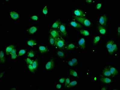 IHC-plus™ TXN / Thioredoxin / TRX Antibody (aa 2-105)