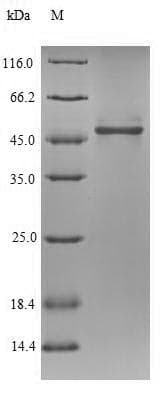 Drosophila melanogaster ND-75 Protein (Recombinant 6His-SUMO, N-terminus)