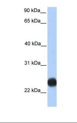 TMEM123 / Porimin Antibody (C-Terminus)