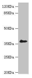 IHC-plus™ Polyclonal Rabbit anti-Human LIMS1 / PINCH Antibody (IHC, IF, WB)