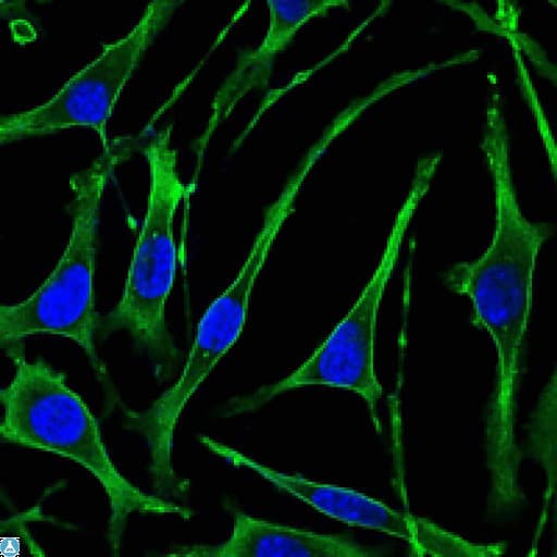 Monoclonal Mouse anti-Human PTHR / PTHR1 Antibody (IHC, IF, WB)