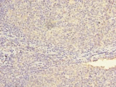 NXNL2 Antibody