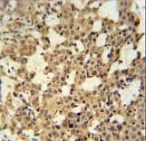 MCMBP / C10orf119 Antibody (aa143-171)