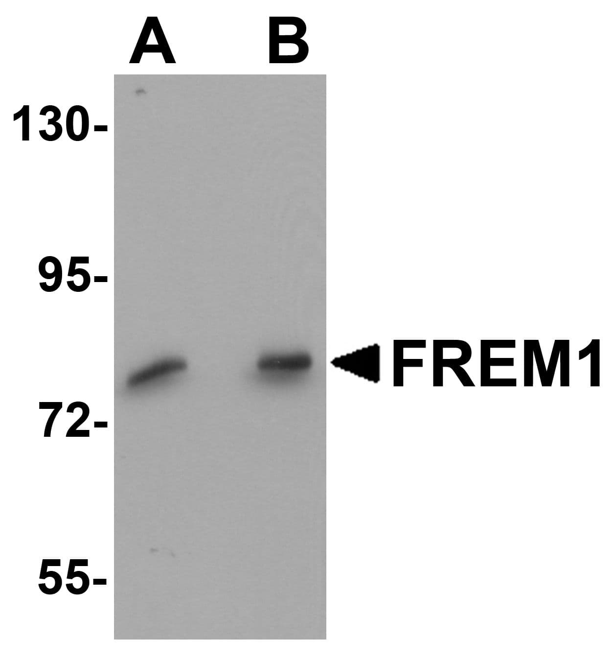 IHC-plus™ FREM1 Antibody