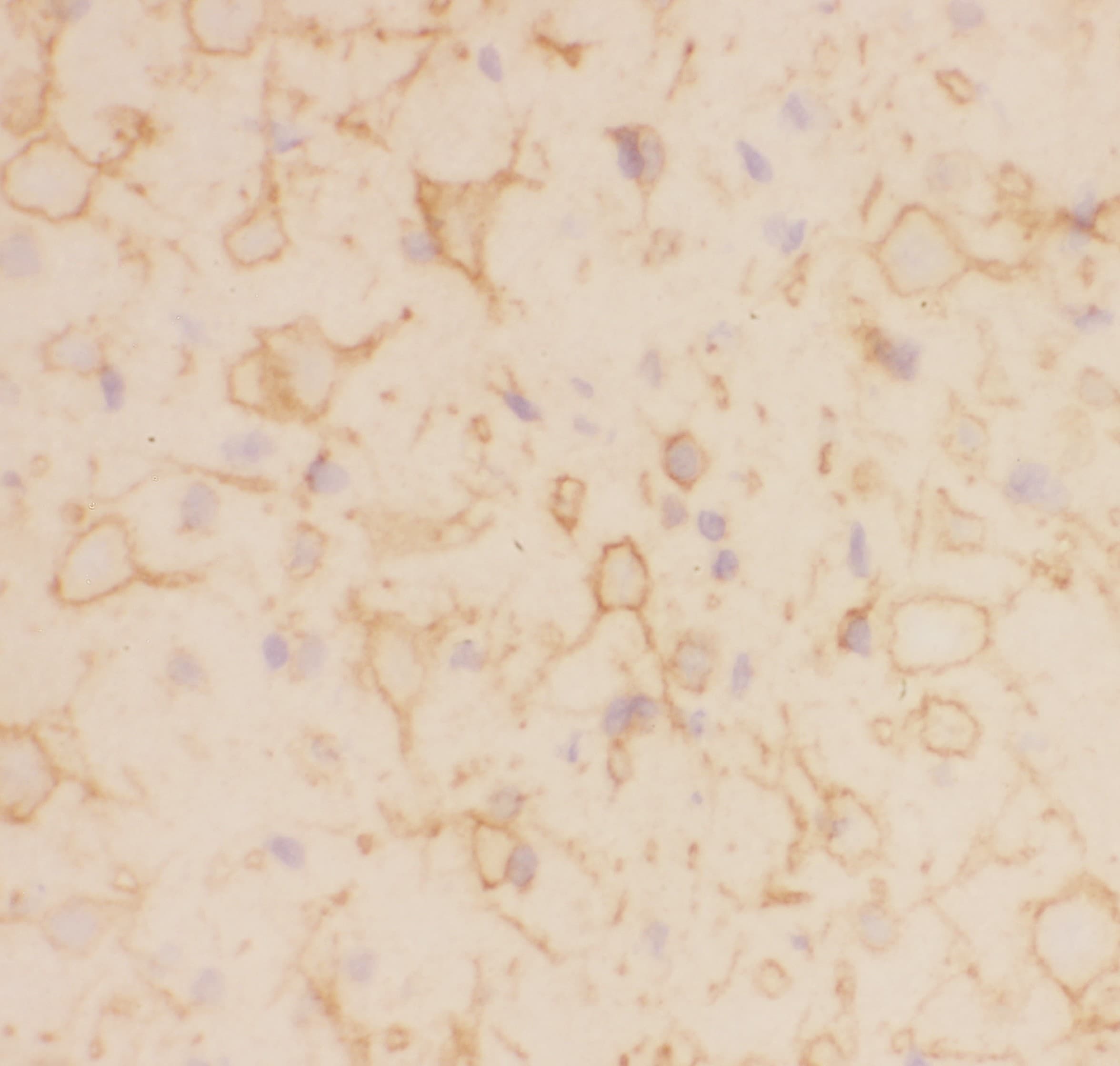 KCNB1 / Kv2.1 Antibody (aa687-858)