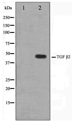 TGFB2 / TGF Beta2 Antibody