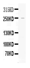 Polyclonal Rabbit anti-Human APOB / Apolipoprotein B Antibody (IHC, WB)