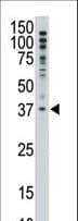 MAGEF1 Antibody (aa274-303)