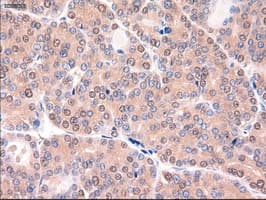 PTCH1 / Patched 1 Antibody (clone OTI5C7)