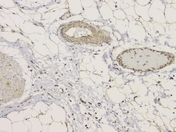 SRCIN1 / SNIP Antibody
