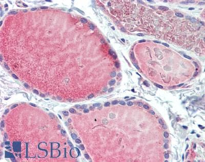 IHC-plus™ Polyclonal Rabbit anti-Human RNF128 / GRAIL Antibody (IHC, WB)