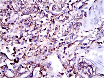 Monoclonal Mouse anti-Human G6PD Antibody (clone 5E+12, IHC, WB)