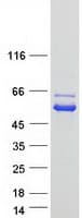 Human NAGS Protein (Recombinant Myc-DDK (Flag))