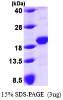Human GLIPR2 Protein (Recombinant His)