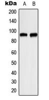 ITPKC Antibody (Internal)