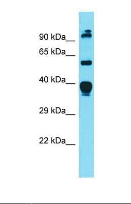 DGAT1 Antibody (aa78-127)