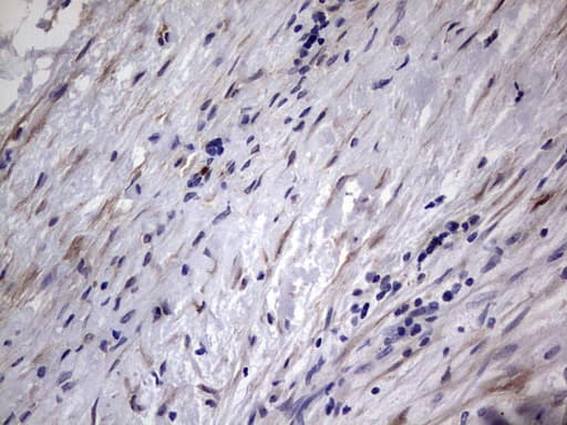 MMP7 / Matrilysin Antibody (aa95-267, clone OTI3G7)