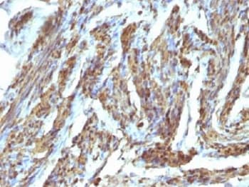 Polyclonal Rabbit anti-Human Calponin Antibody (Azide-free,BSA-free, IHC, IF)