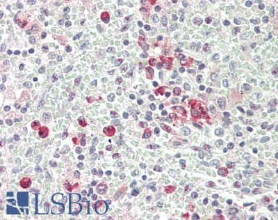 IHC-plus™ Polyclonal Rabbit anti-Human ANKRD44 Antibody (aa37-262, IHC, WB)