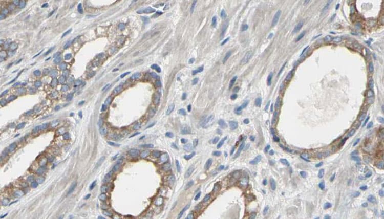 EEF2K Antibody