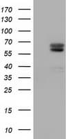 Monoclonal Mouse anti-Human Alpha-Fetoprotein Antibody (clone OTI2E10, IF, WB)
