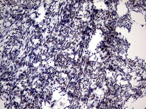 ZNF34 Antibody (aa117-405, clone OTI3G2, Carrier-free)