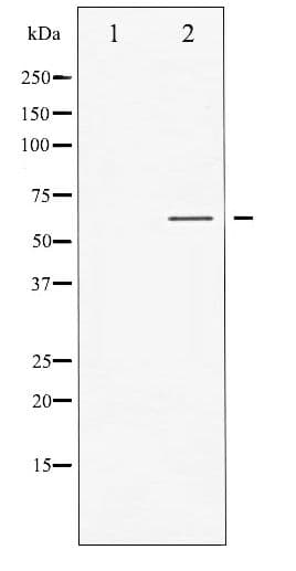 Polyclonal Rabbit anti-Human GABRB1 Antibody (phospho-Ser434, IHC, WB)