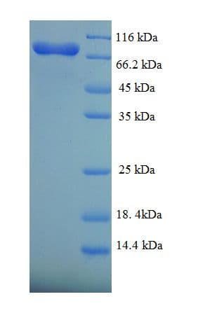 Human FANCC Protein (Recombinant His-SUMO)