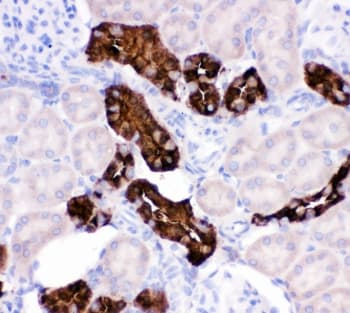 CALB1 / Calbindin Antibody (aa2-175)