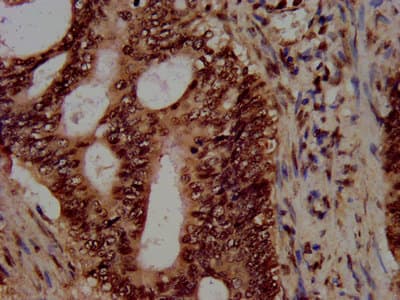 HIST1H3A Antibody